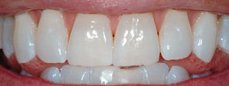 teeth